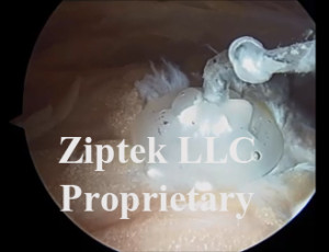 ziptek1